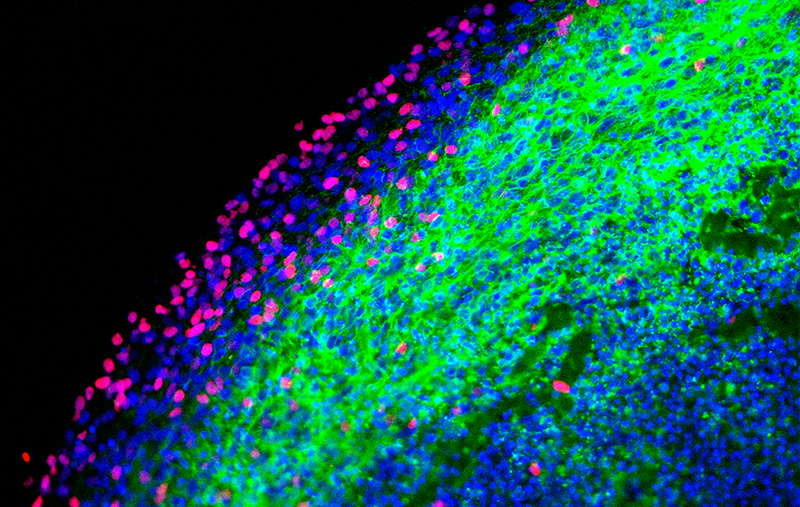 Cerebral organoids and differentiation kits