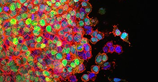 Cytokines for Organoid Culture