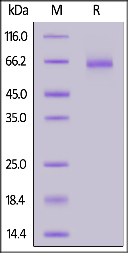 ADAM9 SDS-PAGE