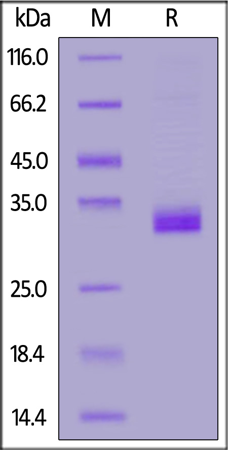 Human Angiopoietin-like 4 (166-406), His Tag (Cat. No. AN4-H5243) SDS-PAGE gel