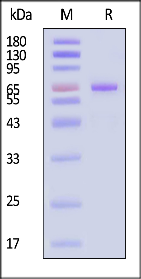 Human Cadherin-3, His Tag (Cat. No. CA3-H52H3) SDS-PAGE gel