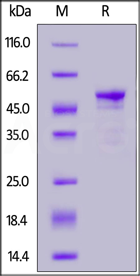 Carbonic Anhydrase IX SDS-PAGE