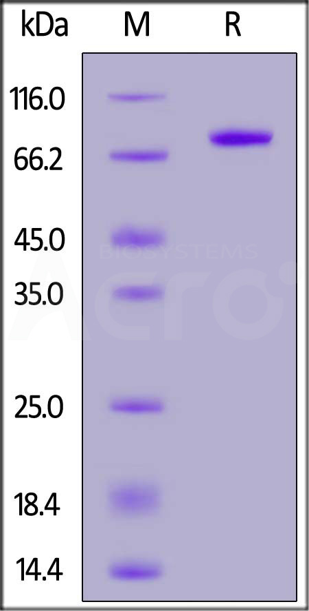 Carbonic Anhydrase IX SDS-PAGE