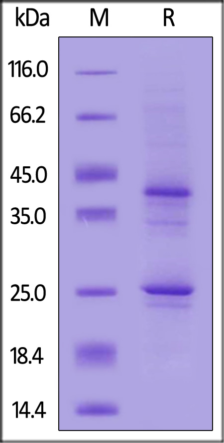 CD20 SDS-PAGE