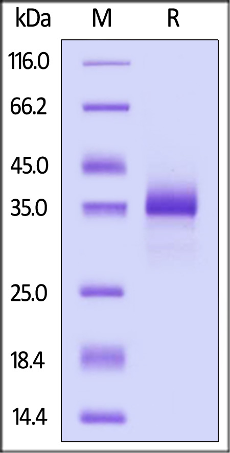 Biotinylated Human CD72, His,Avitag (Cat. No. CD2-H82E3) SDS-PAGE gel