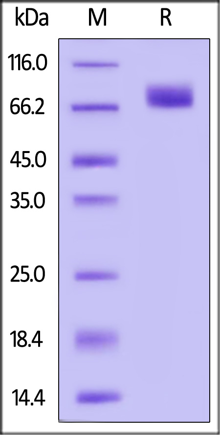 Canine CD36, His Tag (Cat. No. CD6-C52H6) SDS-PAGE gel