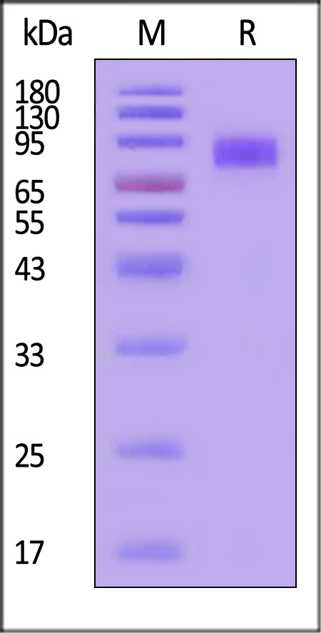 CD117 SDS-PAGE