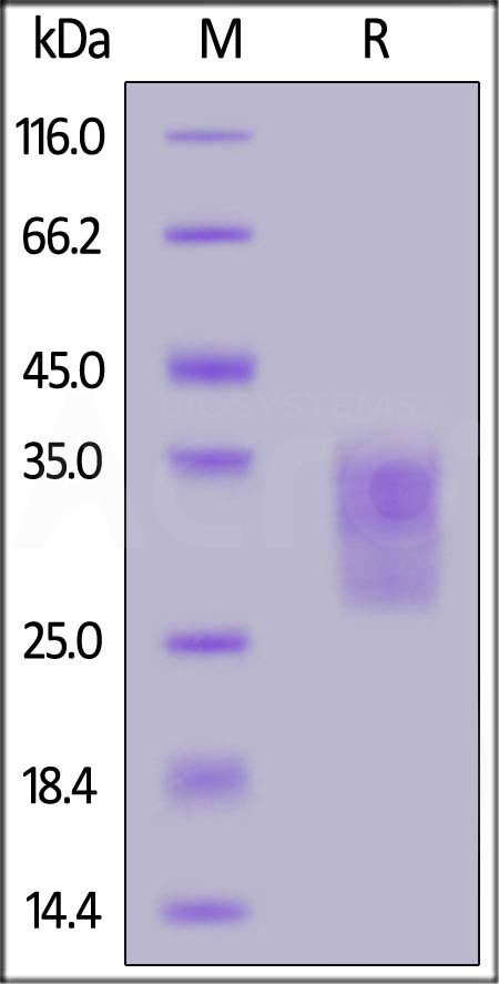 Mouse CD79B Protein, His Tag (Cat. No. CDB-M52H4) SDS-PAGE gel