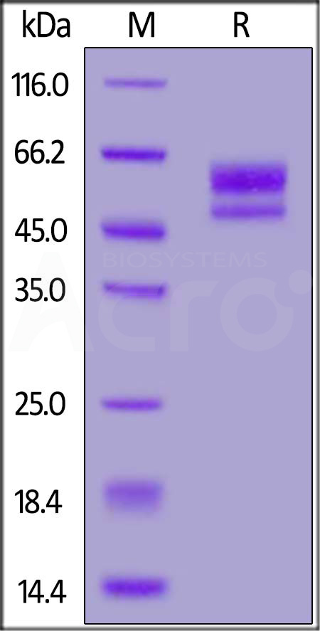 CD3E & CD3D SDS-PAGE