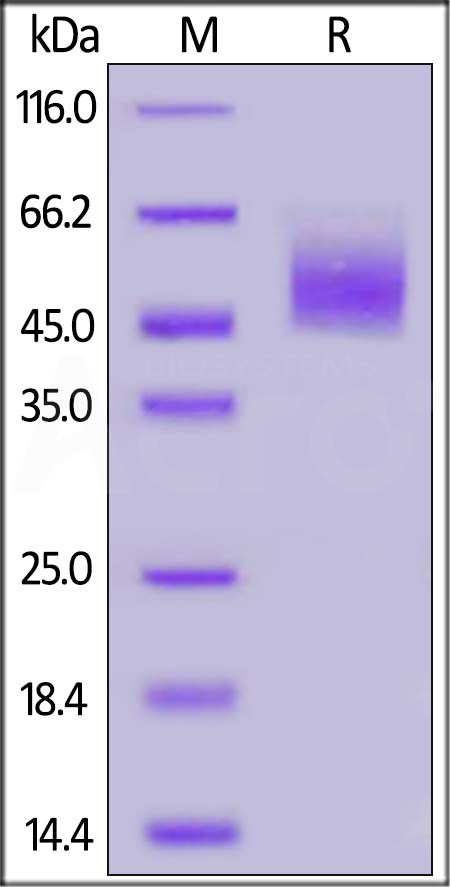 Human CRTAM, His Tag (Cat. No. CRM-H52H3) SDS-PAGE gel