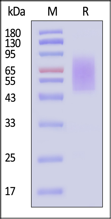 Human CX3CL1, His Tag (Cat. No. CX1-H5221) SDS-PAGE gel