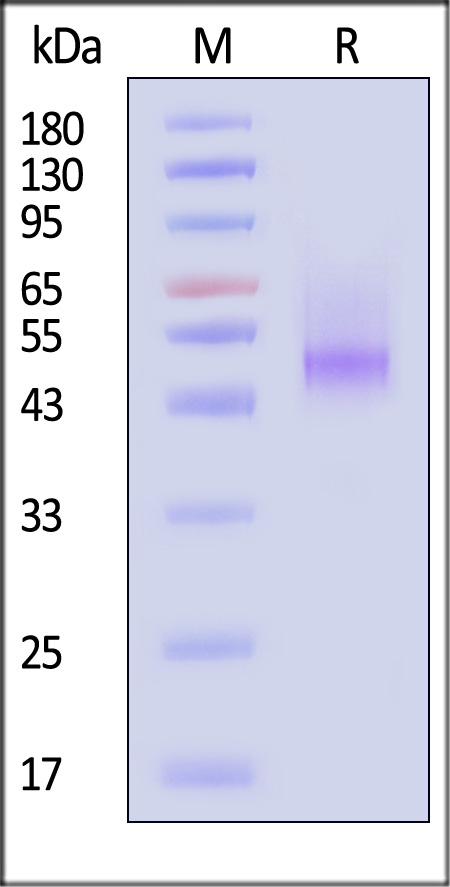 Human Decorin, His Tag (Cat. No. DE1-H5223) SDS-PAGE gel