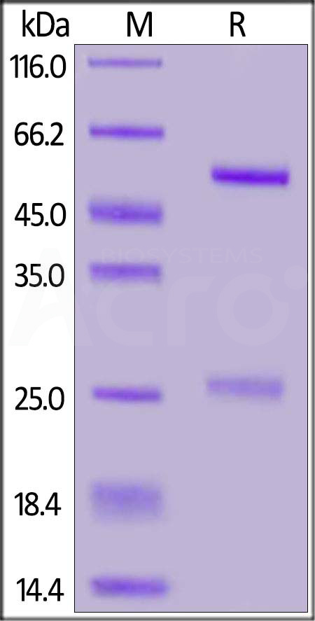 IgG control SDS-PAGE