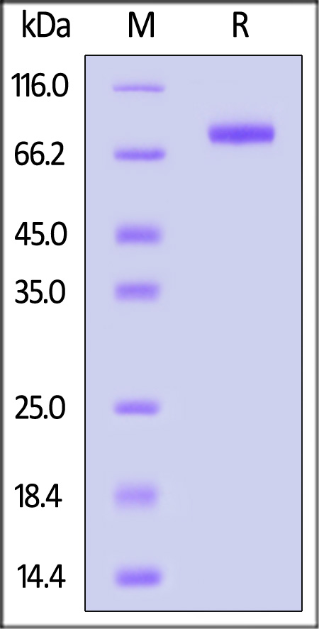 Human BST1, His Tag (Cat. No. ENN-H52H9) SDS-PAGE gel