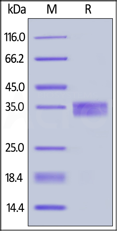 Mouse EpCAM, His Tag (Cat. No. EPM-M5227) SDS-PAGE gel