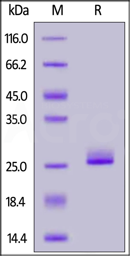 Human FGF-21, His Tag (Cat. No. FG1-H5243) SDS-PAGE gel