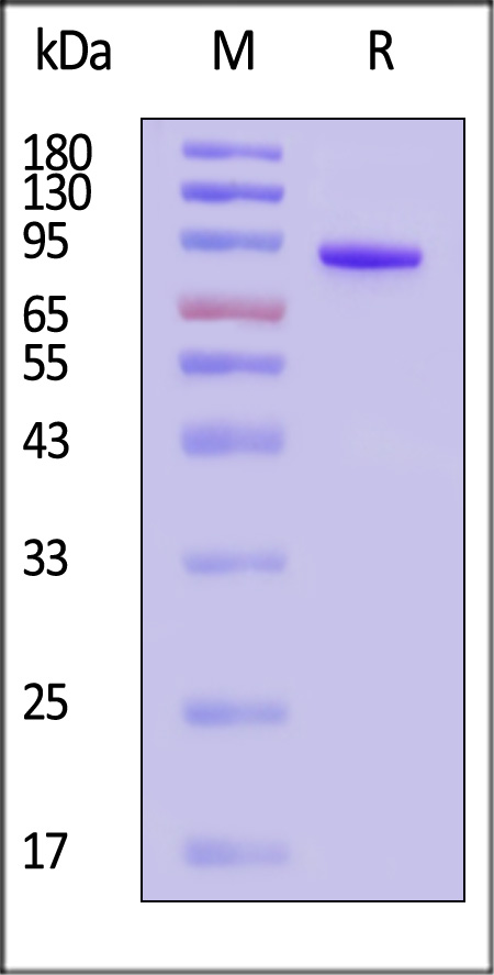 Coagulation factor XI SDS-PAGE