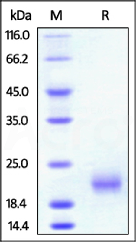 Rat GITR, His Tag (Cat. No. GIR-R5222) SDS-PAGE gel