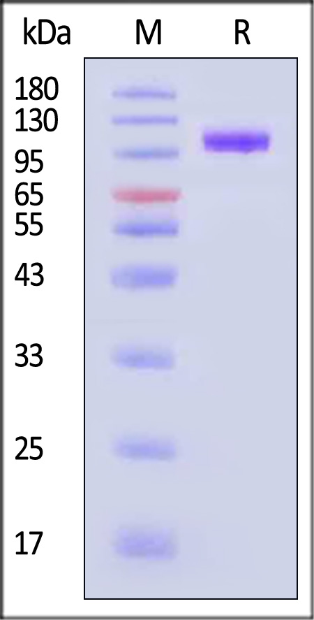 Glycoprotein B/gB (EBV) SDS-PAGE