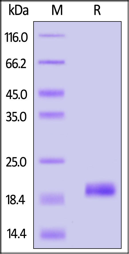 GMF-beta SDS-PAGE