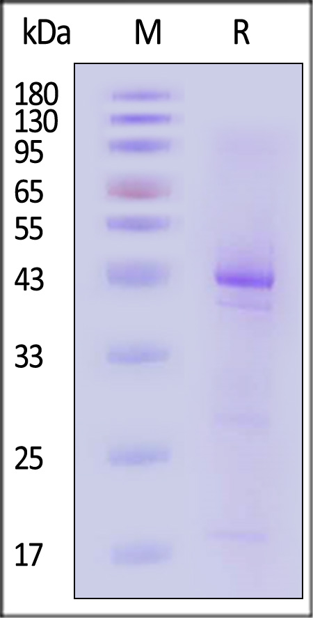 Envelope glycoprotein gp41/gp41 (HIV) SDS-PAGE