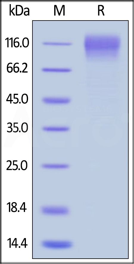 GP120 SDS-PAGE