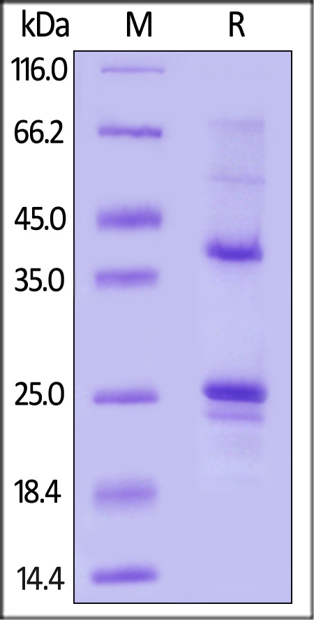 GPRC5D SDS-PAGE