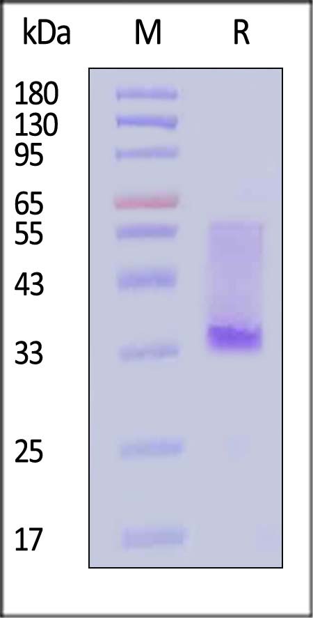 GPRC5D SDS-PAGE