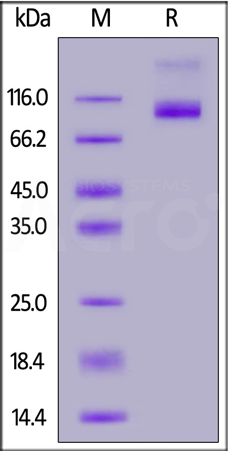 GUCY2C SDS-PAGE