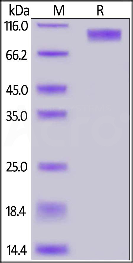 GUCY2C SDS-PAGE