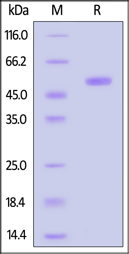 Biotinylated Human GUCY2D, His,Avitag (Cat. No. GUD-H82E6) SDS-PAGE gel