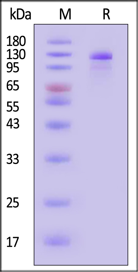 Her2 SDS-PAGE