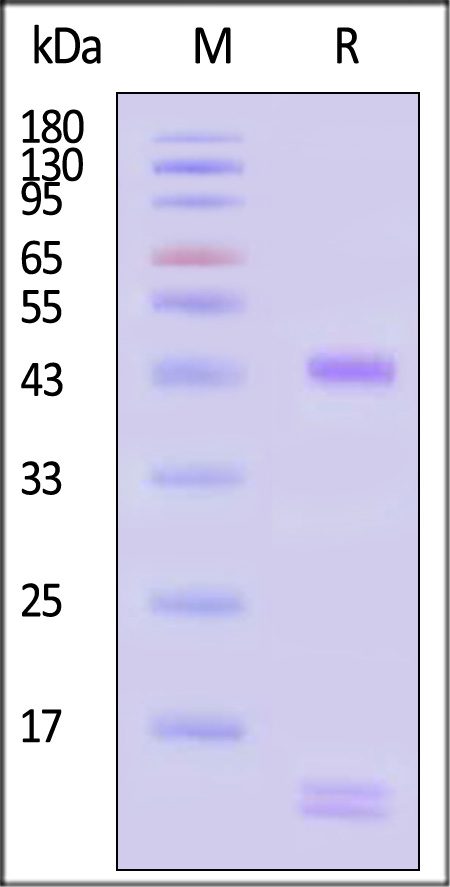 HLA-A*0201 & B2M & NY-ESO-1 (SLLMWITQV) SDS-PAGE