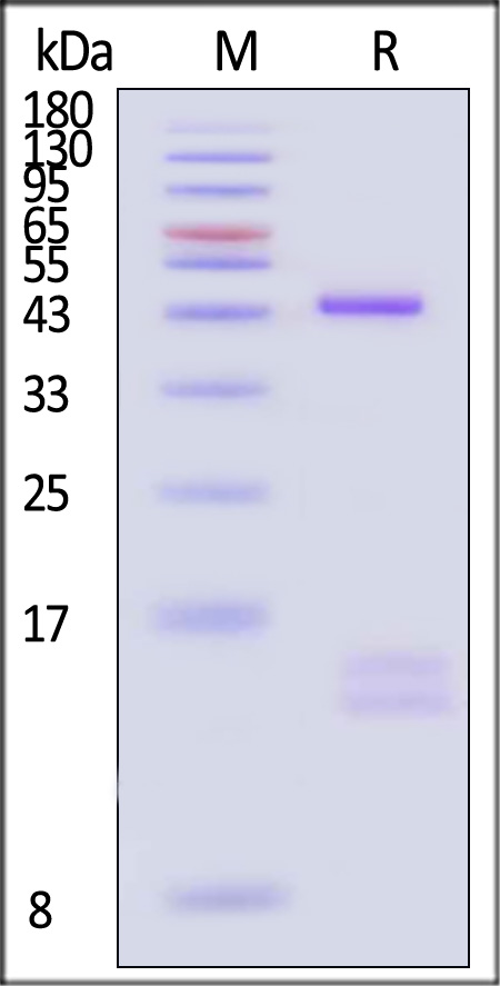 HLA-A*02:01 & B2M & NY-ESO-1 SDS-PAGE