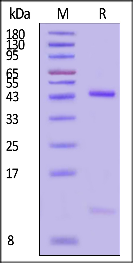 HLA-B*0702 & B2M & HPV16 E7 (KPTLKEYVL) SDS-PAGE