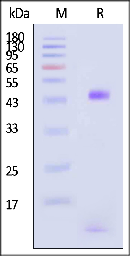 HLA-A*0201 & B2M & CMV pp65 SDS-PAGE