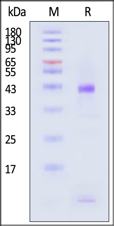 HLA-A*0301 & B2M & KRASG12D (VVVGADGVGK) SDS-PAGE