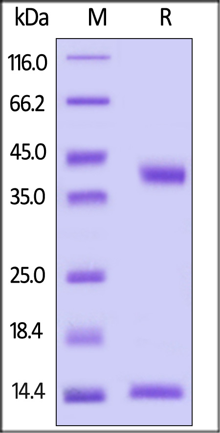 HLA-G & B2M & Peptide (RIIPRHLQL) SDS-PAGE