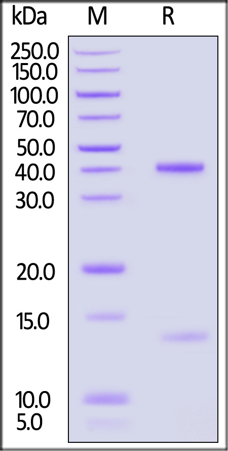 HLA-A*0201 | B2M & HIV Gag SDS-PAGE