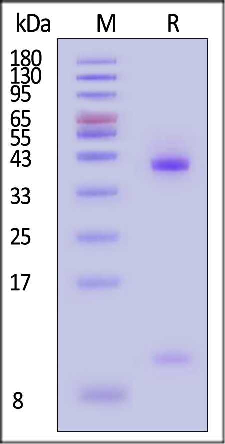 HLA-A*1101 & B2M SDS-PAGE