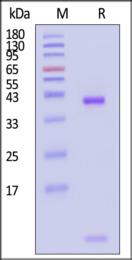 HLA-A*0201 & B2M & Vaccinia virus (LLSYYVVYV) SDS-PAGE