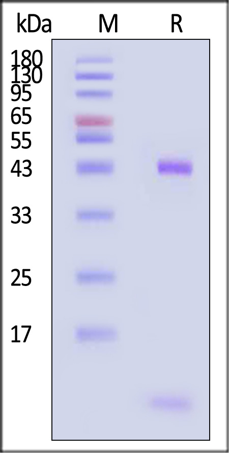 HLA-A*0201 & B2M & Vaccinia virus (VLYNGVNYL) SDS-PAGE