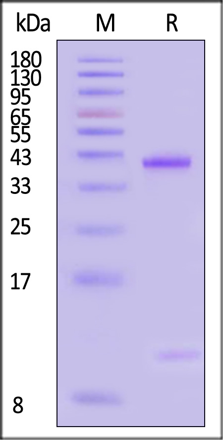 HLA-A*1101 & B2M & KRASG12V (VVVGAVGVGK) SDS-PAGE