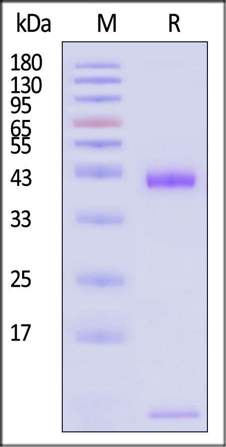 HLA-A*1101 & B2M & KRASG12V (VVVGAVGVGK) SDS-PAGE