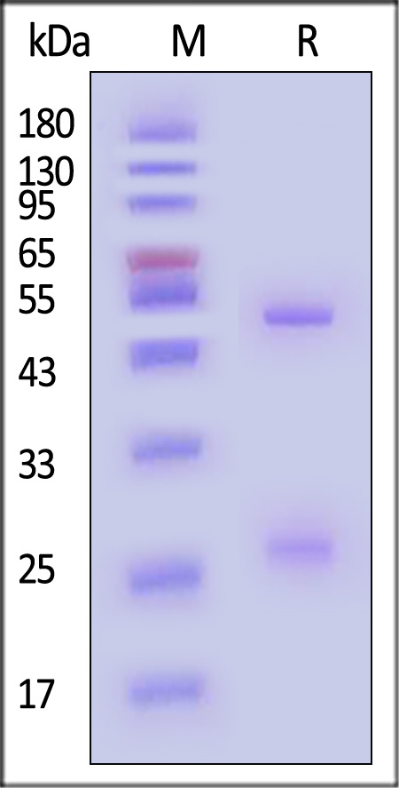 Mumps virus HN SDS-PAGE