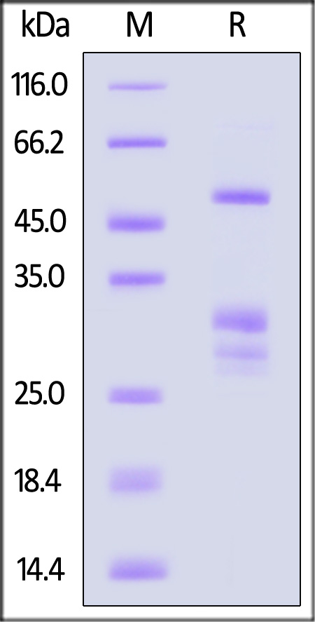 HSP90AA1 SDS-PAGE