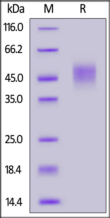 IFN-alpha/beta R2 SDS-PAGE