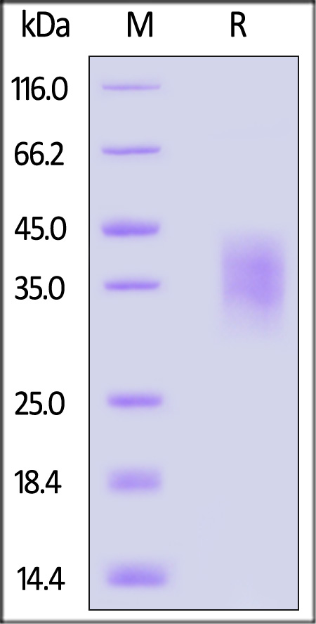 IFN-alpha/beta R2 SDS-PAGE