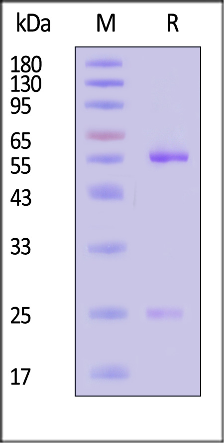 IL15 SDS-PAGE