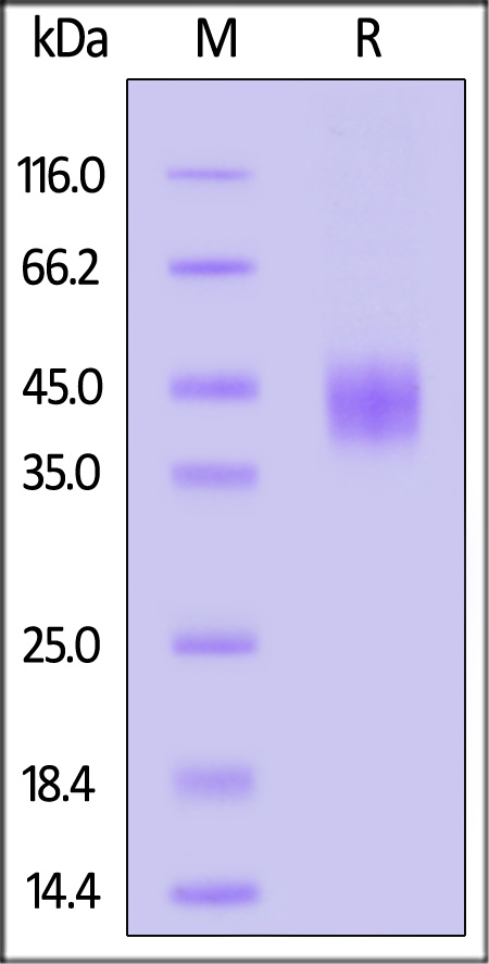 Human IL-20 R alpha Protein, His Tag (Cat. No. ILA-H52H3) SDS-PAGE gel